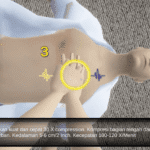 CPR